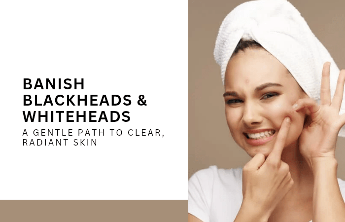 Banish Blackheads & Whiteheads: A Gentle Path to Clear, Radiant Skin - Lotshop.pk