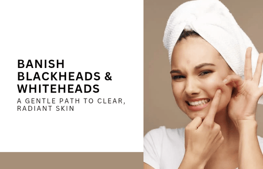 Banish Blackheads & Whiteheads: A Gentle Path to Clear, Radiant Skin - Lotshop.pk