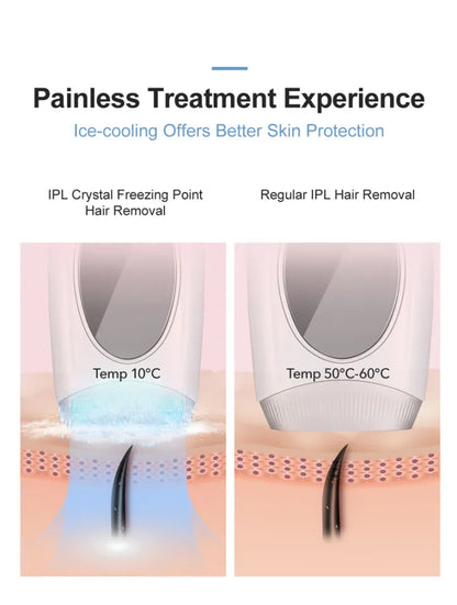 inFace Ice Cooling IPL Hair Remover – Affordable Price in Pakistan