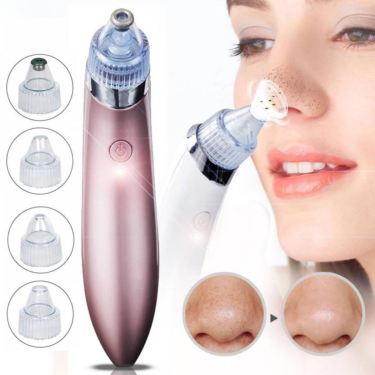 Mengshahayd Acne Pore Cleaner – XN - 8030 | Advanced Suction Technology | Lotshop.pk - Lotshop.pk