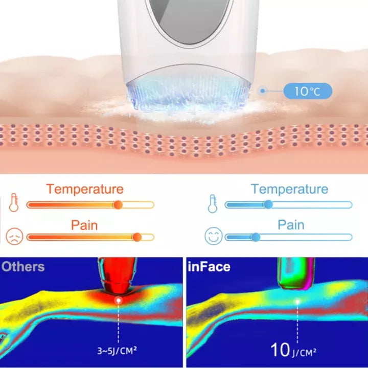 inFace COOL IPL Crystal Freezing Point Hair Removal Device with Ice Cooling Technology